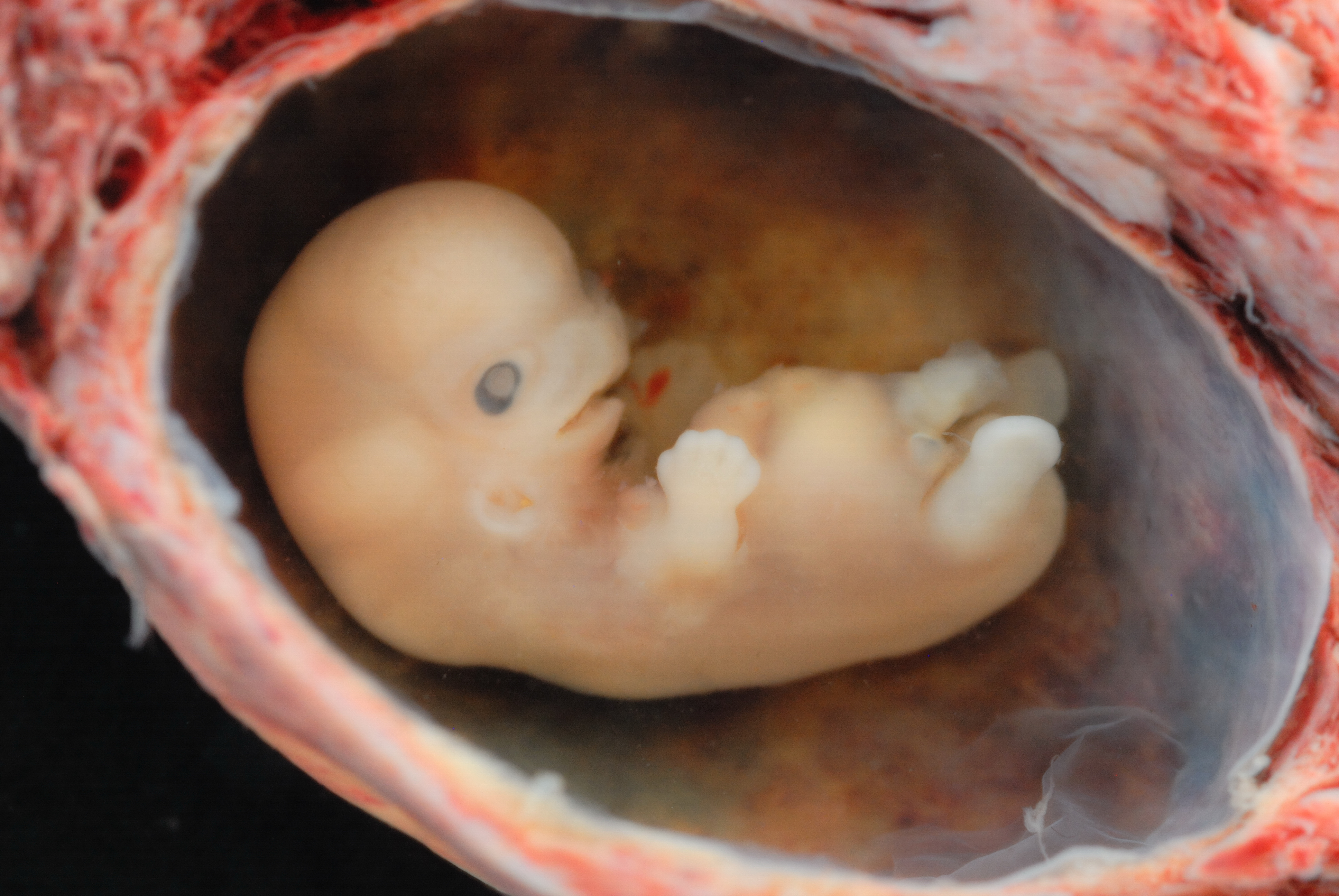 https://arquimedia.s3.amazonaws.com/27/formacion/embrion-humano-01jpg.jpg