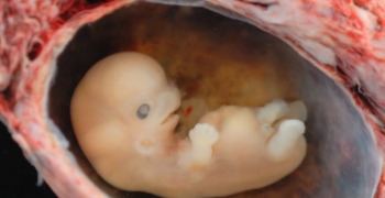 https://arquimedia.s3.amazonaws.com/27/formacion/embrion-humano-01jpg.jpg